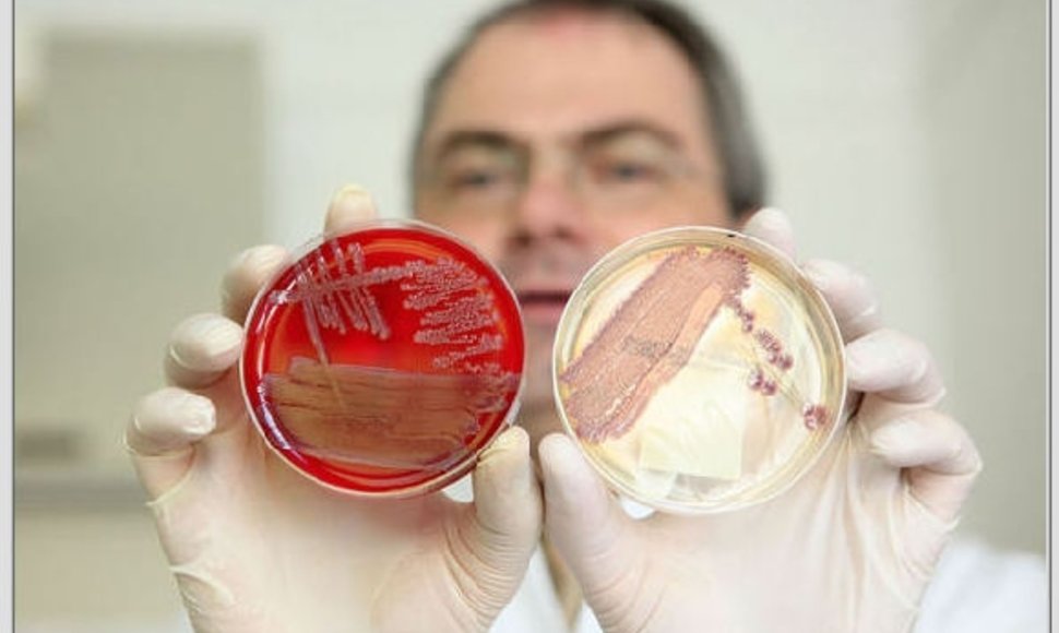 Bakterijų kolonijos