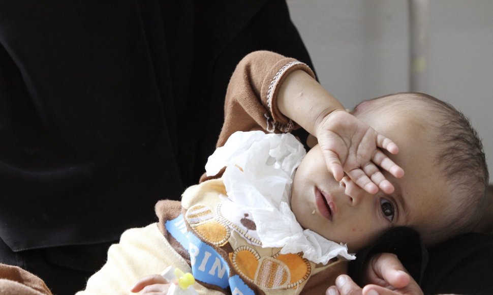 Nuo nepakankamos mitybos kenčiantys vaikai Jemene