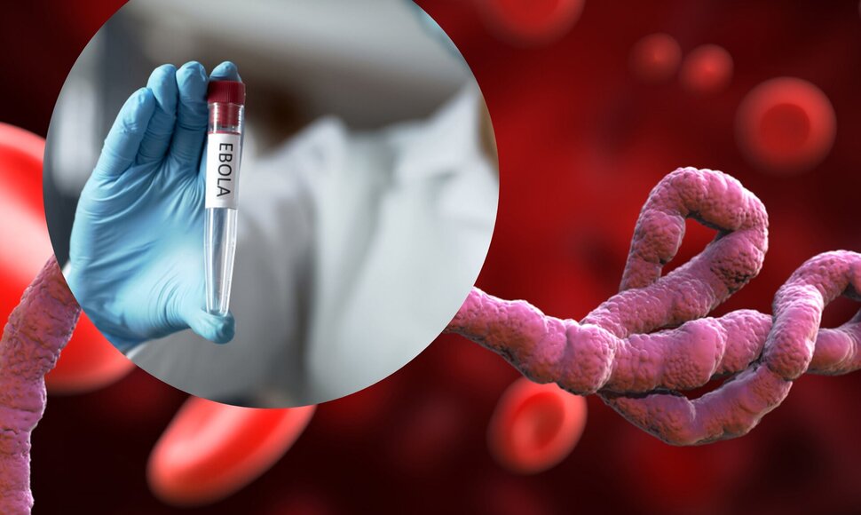 Ebola