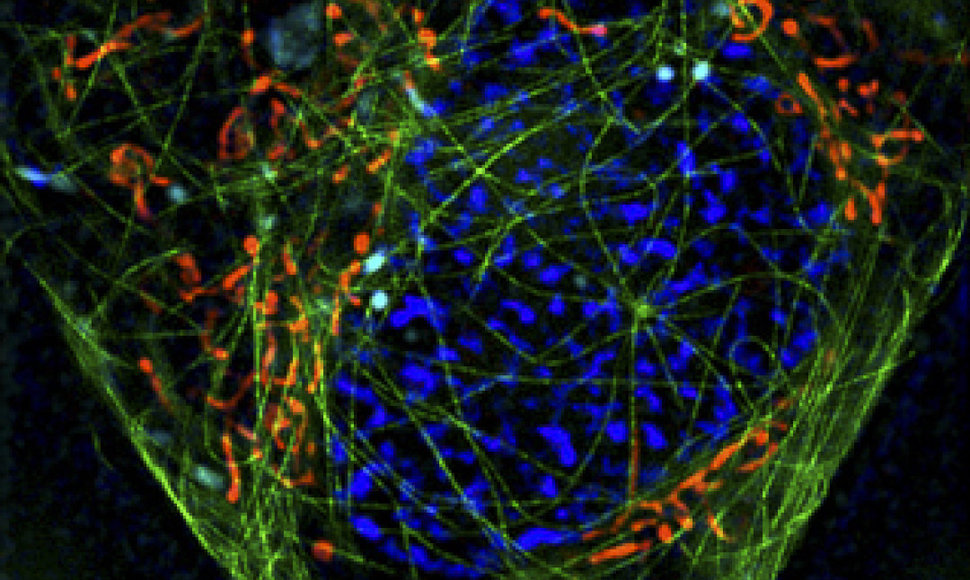 Daugiaspalvės superskiriamosios gebos mikroskopijos pavyzdys: žalia - ląstelės citoskeleto komponentas tubulinas, radona - ląstelės jėgainės mitochondrijos, šviesiai mėlyna – ląstelės virškinimo sistemos komponentas lizosomos, tamsiai mėlyna – ląstelės informacijos saugykla branduolys. Paveikslėlis 
