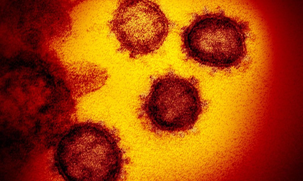 Koronaviruso kūneliai iš arčiau: matomi spygliukai, suteikę šiam virusui pavadinimą