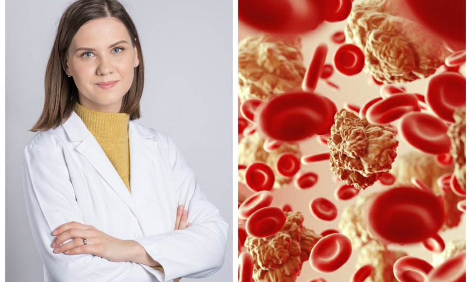 Gyd. hematologė Rūta Semaškevičienė ir asociatyvi nuotr. 