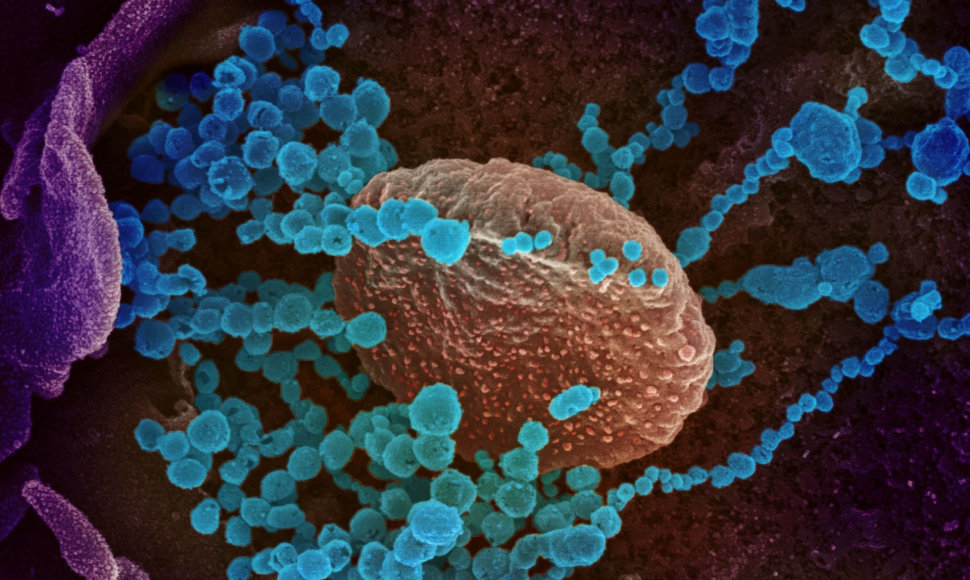 Skenuojančio elektroninio mikroskopo užfiksuotas vaizdas: naujojo koronaviruso kūneliai (mėlyni) veržiasi iš laboratorijoje užkrėstos ląstelės