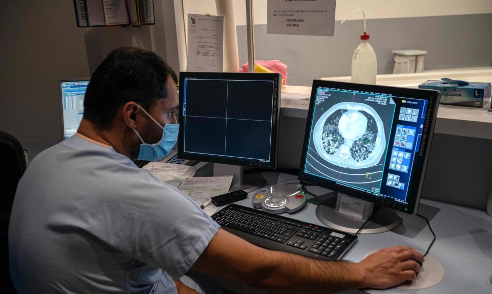 Gydytojas vertina COVID-19 sergančios pacientės plaučių rentgenogramą