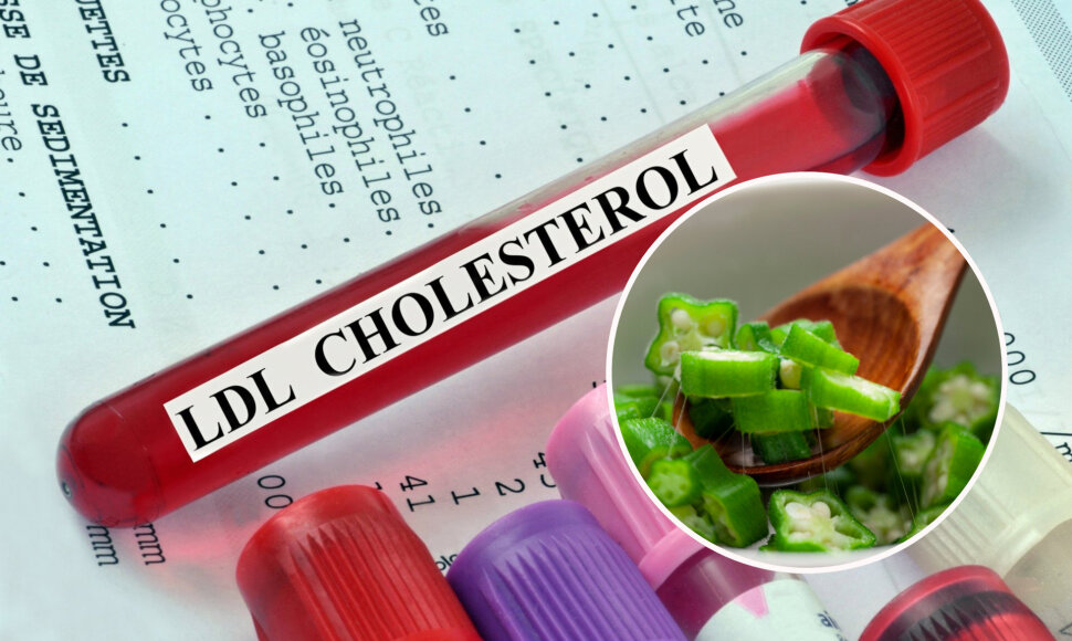 Maisto produktai, kurie mažina cholesterolio kiekį