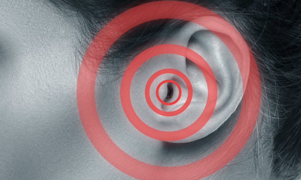 Cypimas ausyse – nemalonus simptomas, su kuriuo susiduria nemaža dalis populiacijos