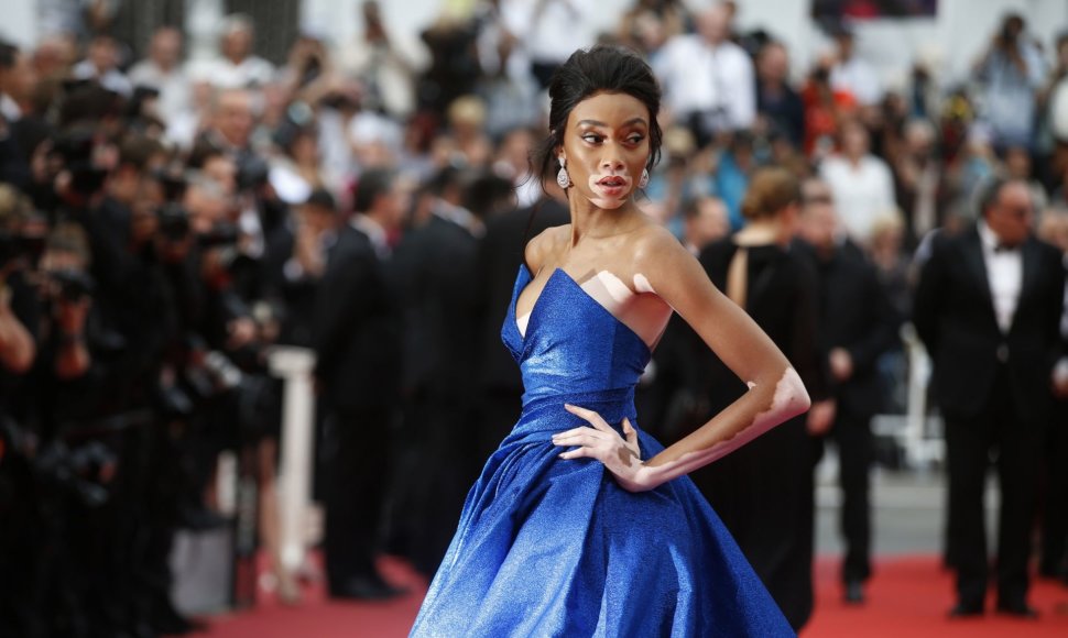 Winnie Harlow