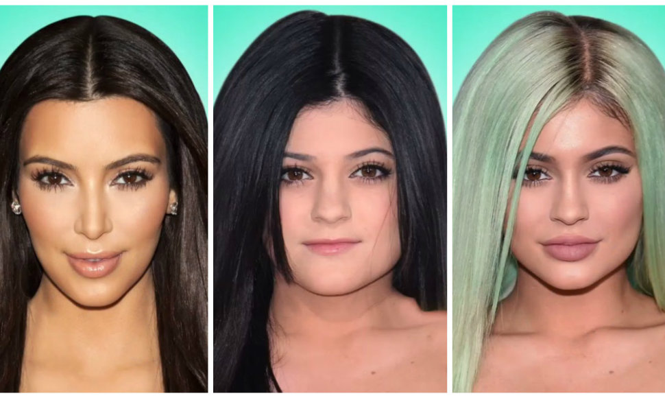 Kim Kardashian ir Kylie Jenner išvaizdos pokyčiai