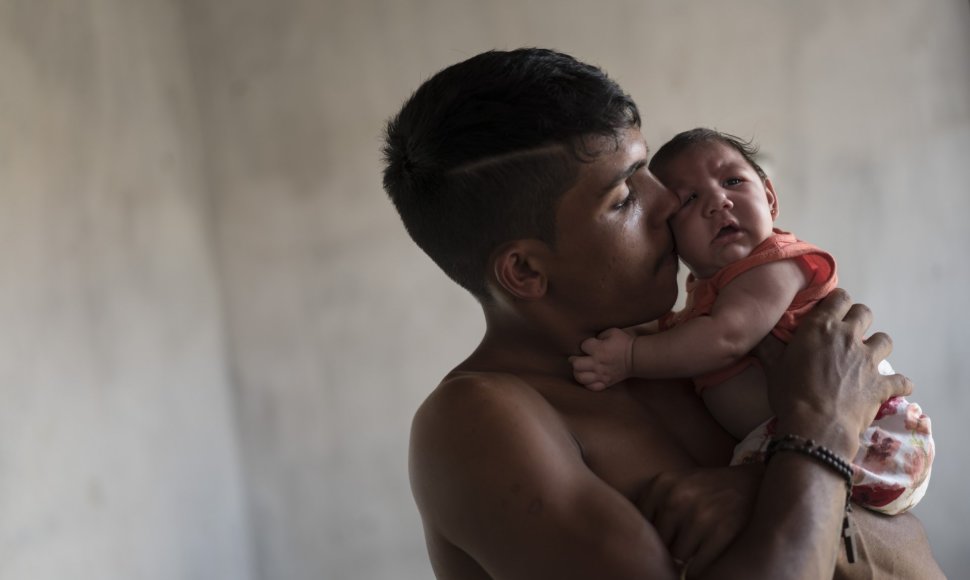 Zika virusu užsikrėtęs kūdikis Brazilijoje