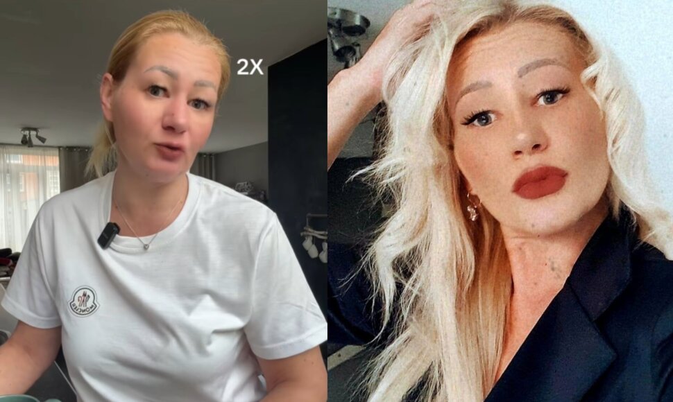 Aušra Dagienė