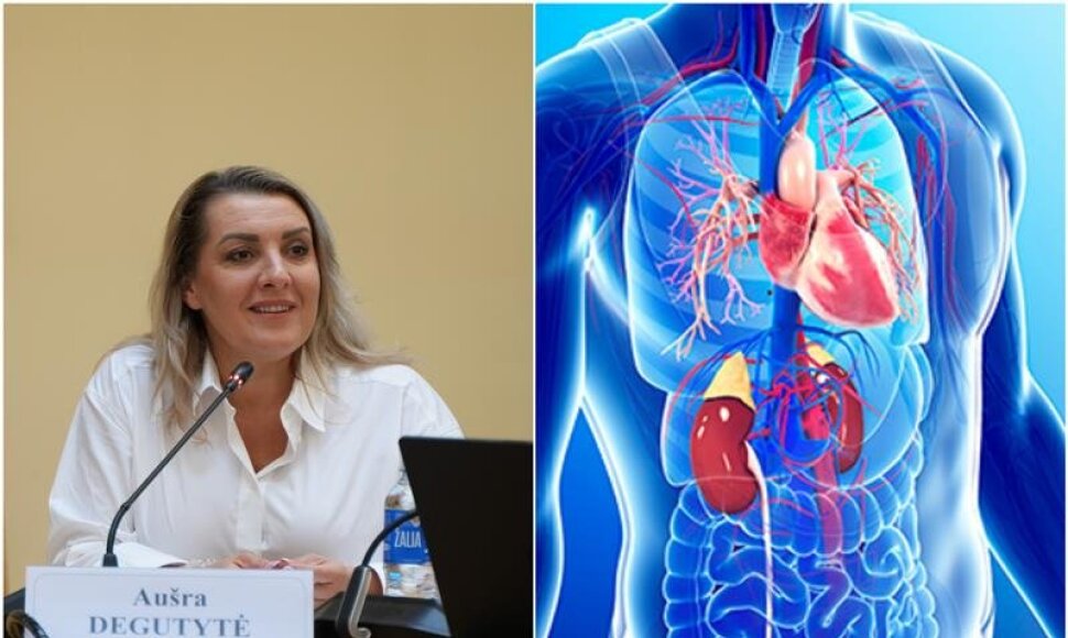 Lietuvos asociacijos &bdquo;Gyvastis&ldquo; prezidentė Au&scaron;ra Degutytė 