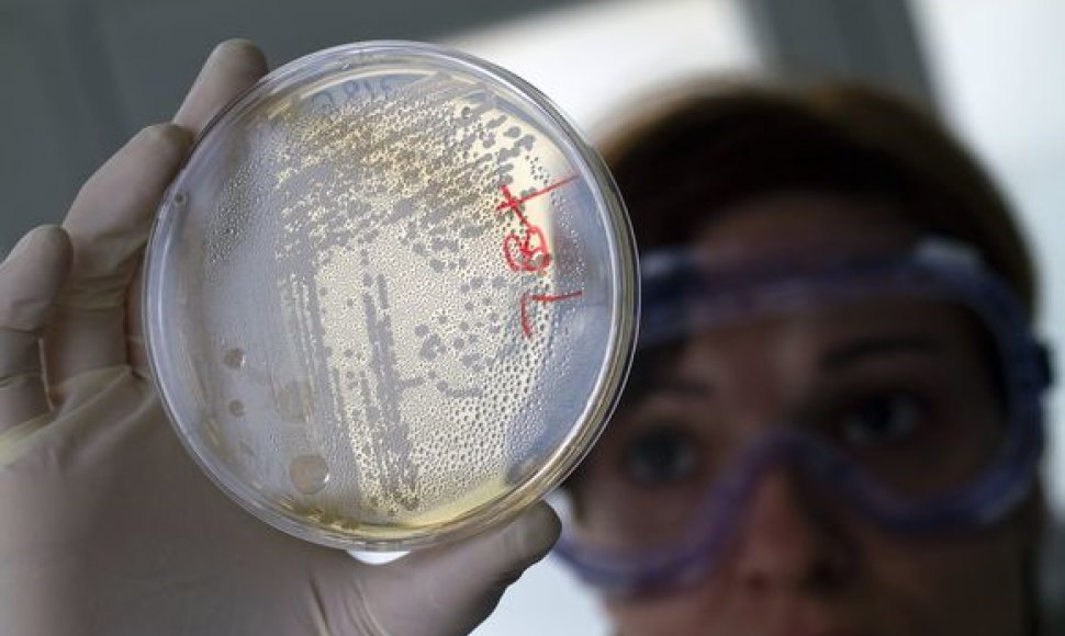 E.coli sukelta žarnyno infekcija