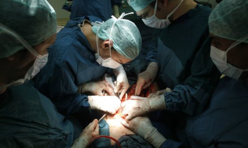 Kepenų transplantacijos operacija