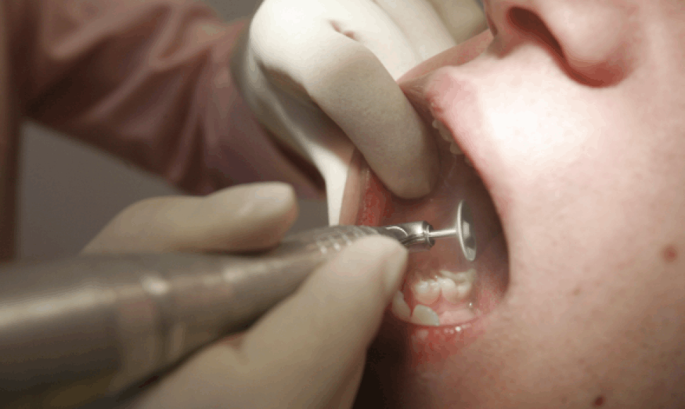 Kompensuojamo dantų protezavimo Klaipėdoje laukia daugiau nei 8 tūkst. žmonių. 