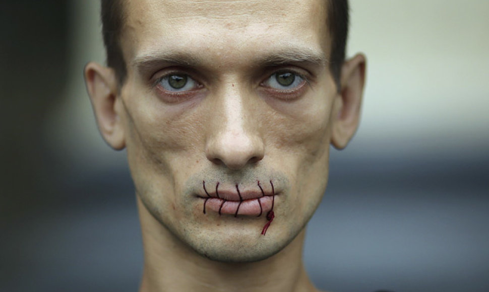 Dailininkas P.Pavlenskis rengia akcijas, kurių metu save žaloja.