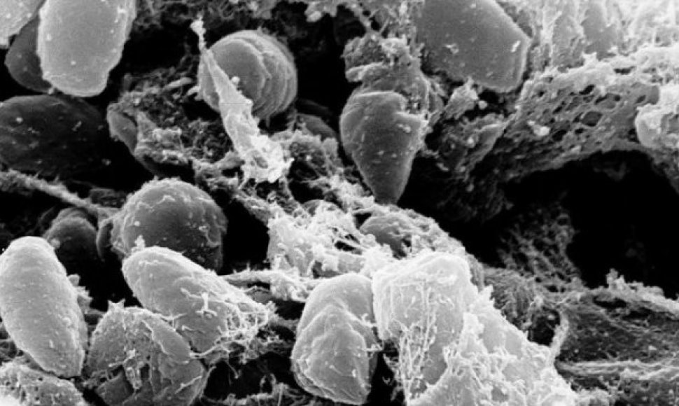 Yersinia pestis bakterija