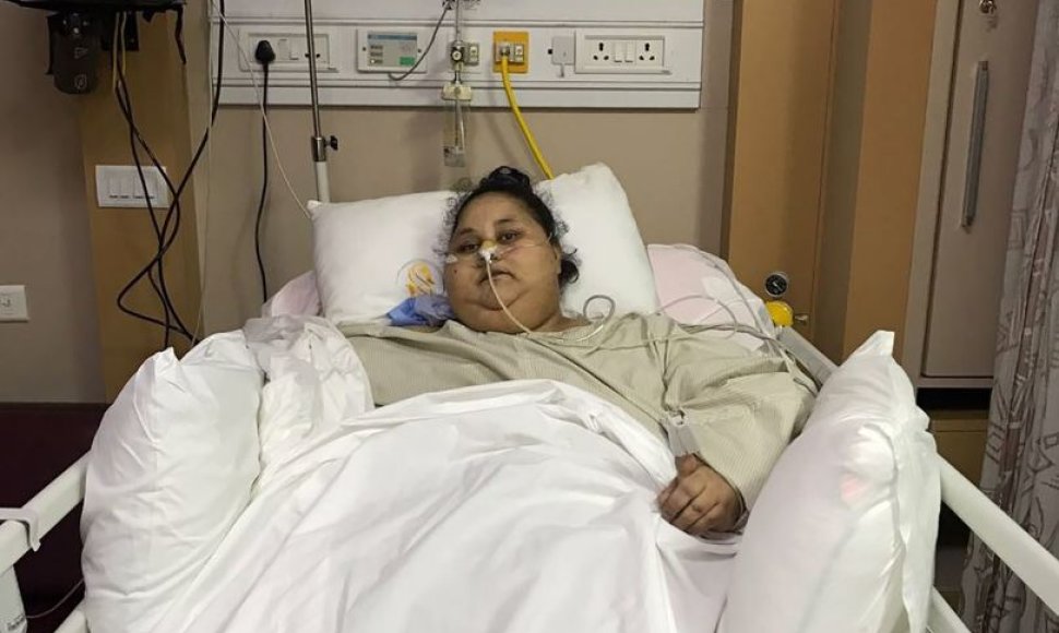 37 metų Egipto pilietė Eman Ahmed Abd El Aty prieš operaciją