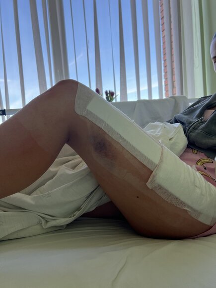Vaida Ra&scaron;inskaitė po operacijos